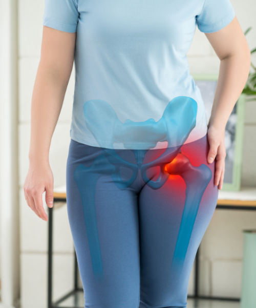 Displazija kolka-slika