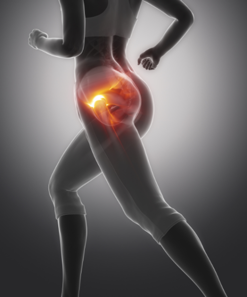 Endoproteza kolka-slika