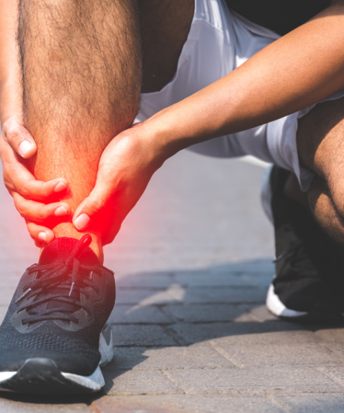 Plantarni fascitis-slika