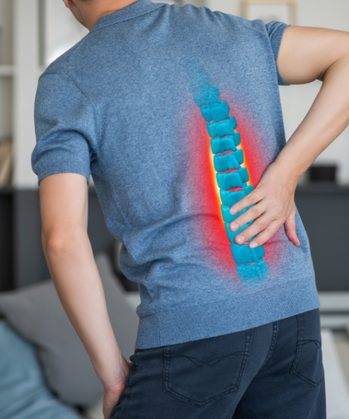 Protruzia diska-slika