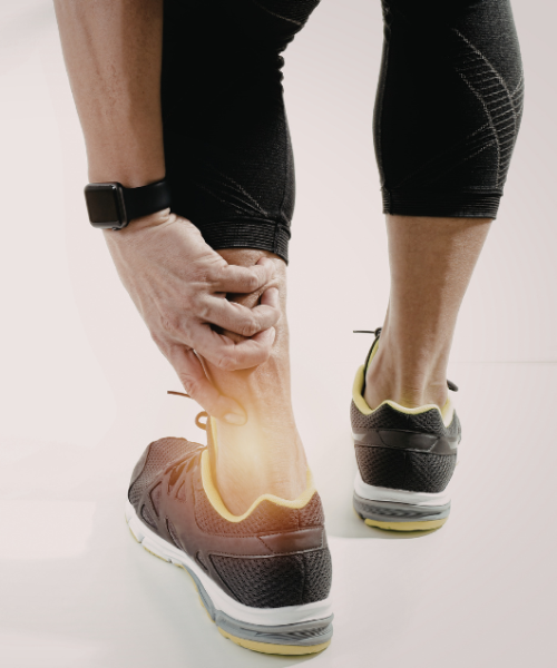 Sindrom nestabilnega gležnja-slika