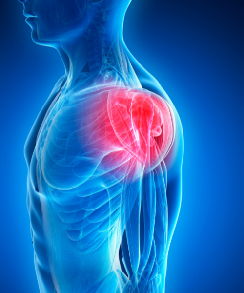 poskodba ac sklepa naslovna