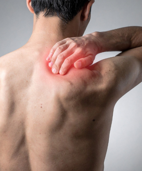 utesnitveni sindrom ramena